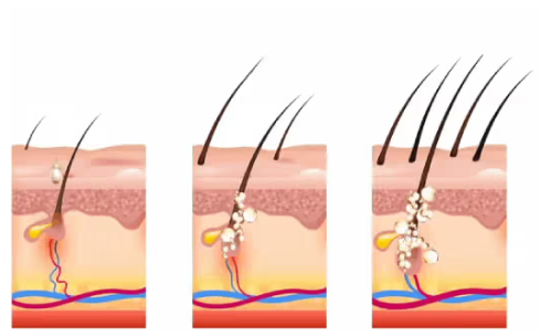 🎄🎁(Christmas Sale – Huge Discounts!) Rosemary Hair Growth Essence 100% Natural Hair Growth🌱