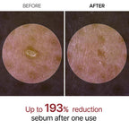 ✨ Peel Shot Duo – Smooth Skin in Seconds