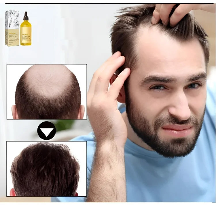 🎄🎁 (Ventes de Noël – Remises exceptionnelles !) Essence de romarin pour la croissance des cheveux 100 % naturelle 🌱 