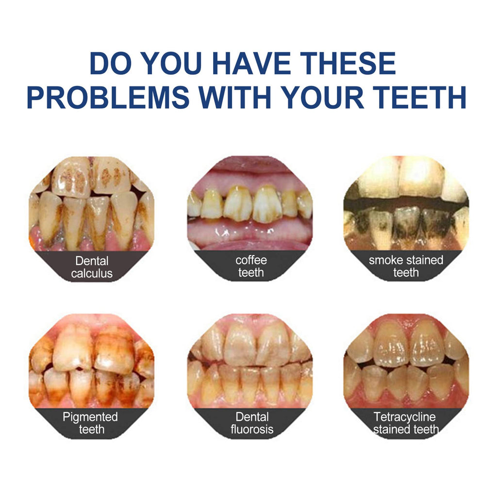 🔥Ends Tonight: Get 60% OFF Before It’s Gone!🎁Fluoride-Free Hydroxyapatite Toothpaste – Gentle Whitening & Enamel Strength for Sensitive Teeth