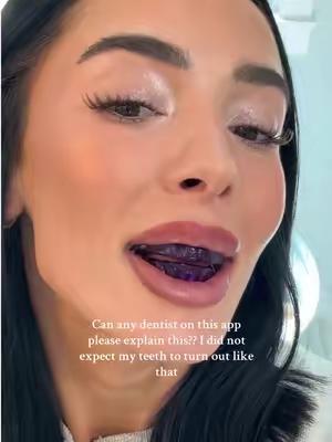 🌸 Brighten Your Smile with Purple Whitening Strips 💜✨