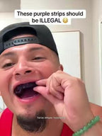 🌸 Brighten Your Smile with Purple Whitening Strips 💜✨