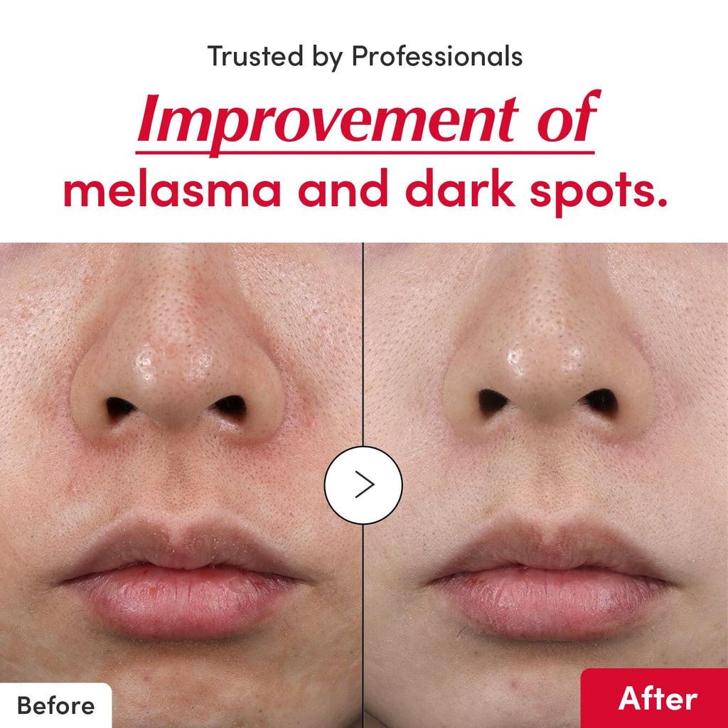 🍒💛 Meet VITAQUEEN Acerola 40%, your daily glow boost