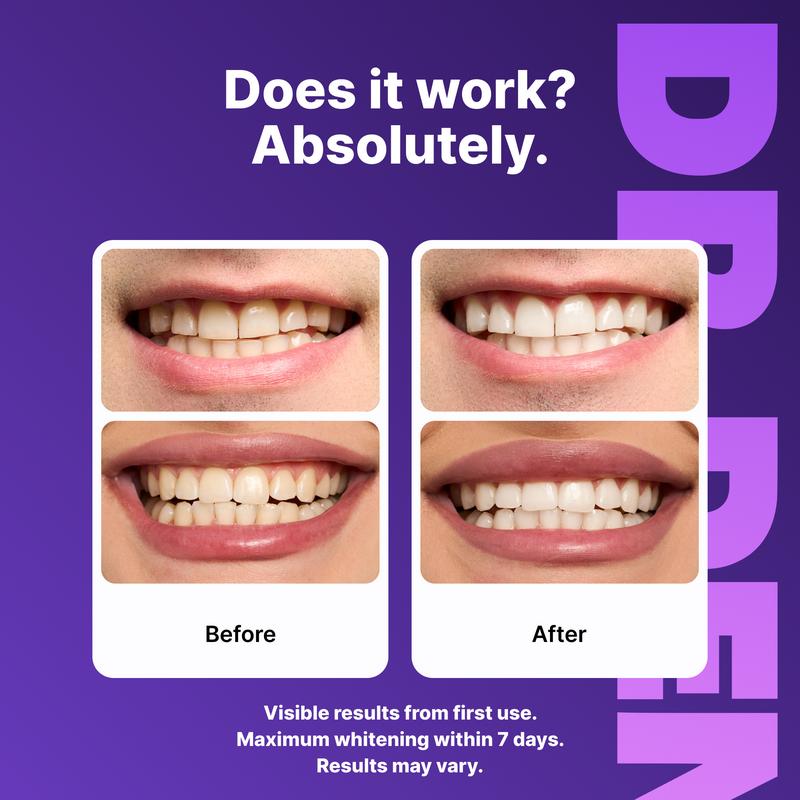 Purple Teeth Whitening Strips - 7/21 Whitening Sessions - Safe for Enamel - Non Sensitive Teeth Whitening - Peroxide-Free